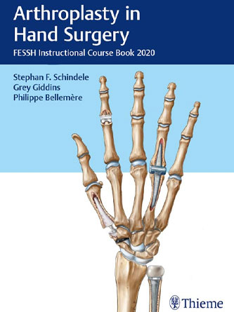 Arthroplasty in Hand Surgery: FESSH Instructional Course Book 2020 (PDF)