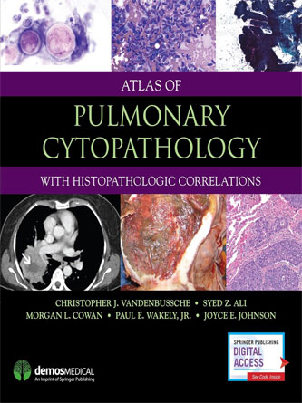 Atlas of Pulmonary Cytopathology (EPUB + PDF Publisher)