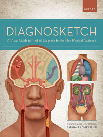 Diagnosketch: A Visual Guide to Medical Diagnosis for the Non-Medical Audience (PDF)