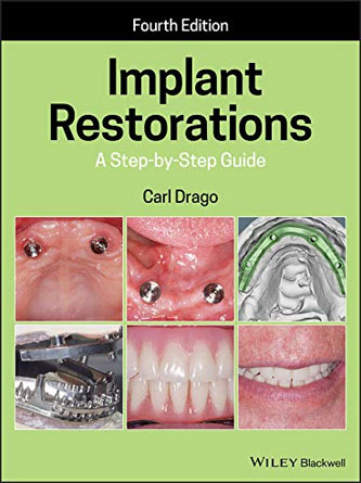 Implant Restorations: A Step-by-Step Guide 4th Edition (Original PDF)