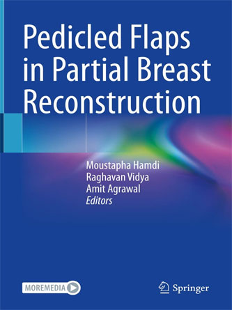 Pedicled Flaps in Partial Breast Reconstruction (PDF)