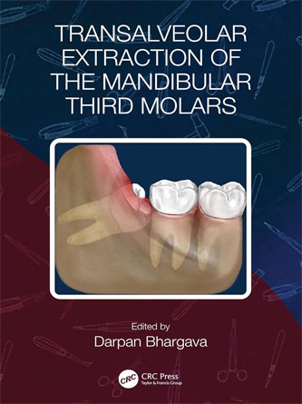 Transalveolar Extraction of the Mandibular Third Molars (PDF)