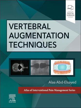 Vertebral Augmentation Techniques (PDF Publisher)