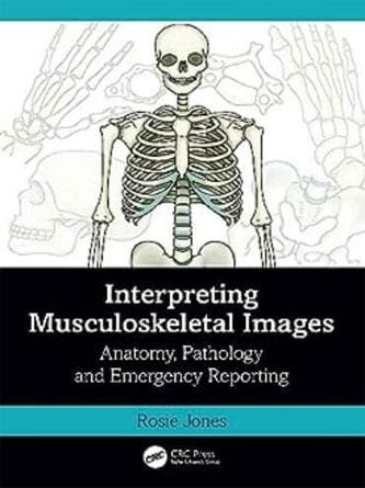 Interpreting Musculoskeletal Images: Anatomy, Pathology and Emergency Reporting (Original PDF)