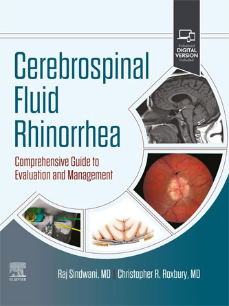 Cerebrospinal Fluid Rhinorrhea: Comprehensive Guide to Evaluation and Management 1ed (PDF + Video)