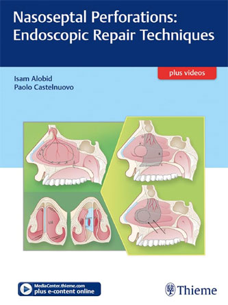 Nasoseptal Perforations: Endoscopic Repair Techniques (PDF)