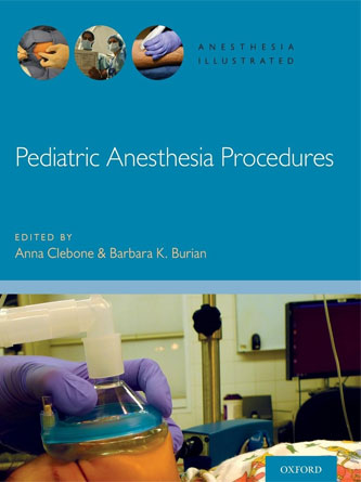 Pediatric Anesthesia Procedures (Anesthesia Illustrated) (PDF from Publisher)