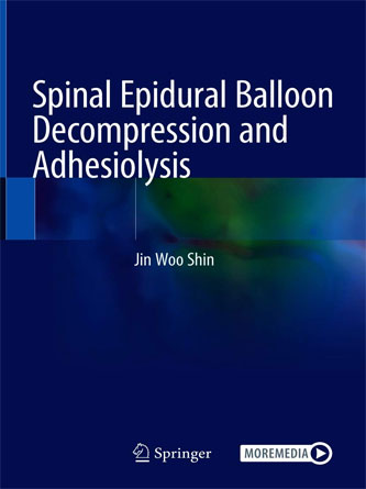 Spinal Epidural Balloon Decompression and Adhesiolysis (PDF Publisher)