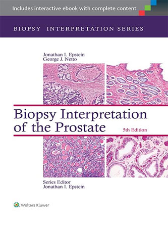 Biopsy Interpretation of the Prostate (Biopsy Interpretation Series) Fifth Edition (PDF)