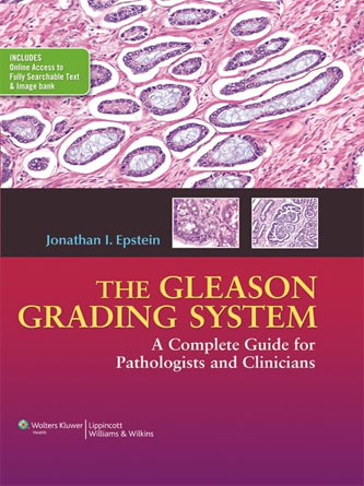 The Gleason Grading System: A Complete Guide for Pathologist and Clinicians, 1st Edition (PDF)