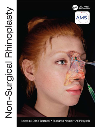 Non-Surgical Rhinoplasty (The PRIME Series) (Original PDF)