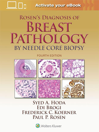 Rosen's Diagnosis of Breast Pathology by Needle Core Biopsy 4th Edition (PDF publisher)