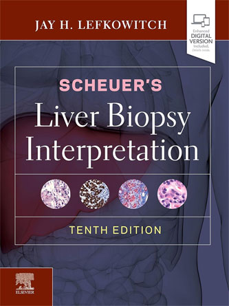 Scheuer's Liver Biopsy Interpretation, 10th Edition (Original PDF)