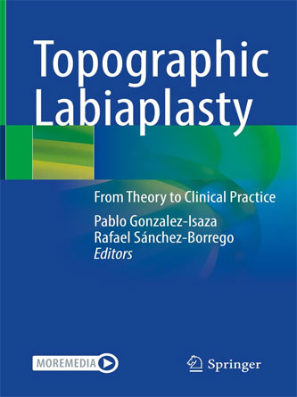 Topographic Labiaplasty: From Theory to Clinical Practice (Original PDF + Video)