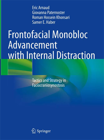 Frontofacial Monobloc Advancement with Internal Distraction: Tactics and Strategy in Faciocraniosynostosis (PDF)