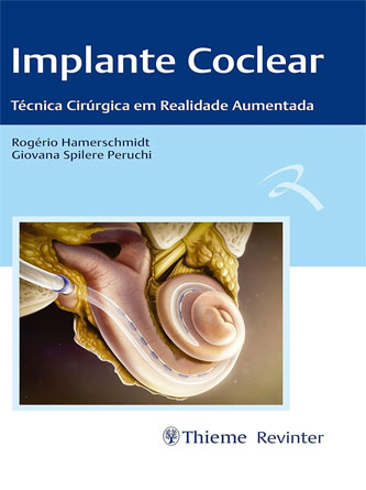 Implante Coclear: Técnicas Cirúrgica em Realidade Aumentada (PDF from Publisher)