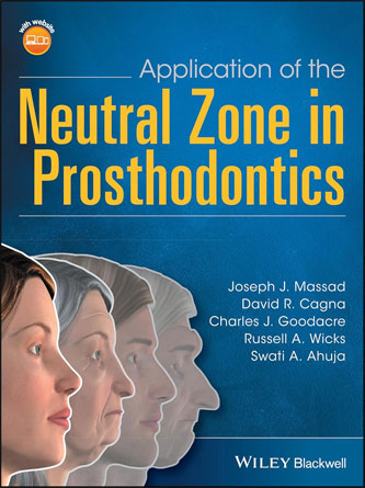 Application of the Neutral Zone in Prosthodontics (PDF)