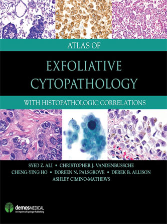 Atlas of Exfoliative Cytopathology: With Histopathologic Correlations (EPUB)