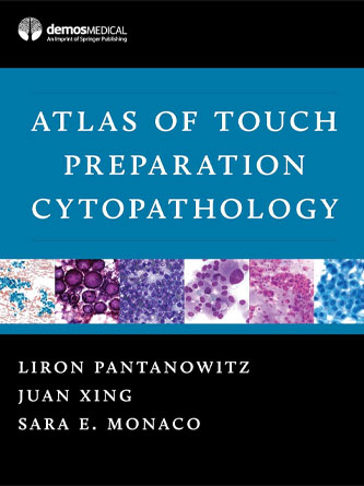 Atlas of Touch Preparation Cytopathology (EPUB)