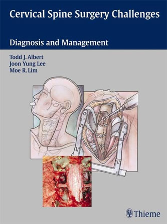 Cervical Spine Surgery Challenges: Diagnosis and Management (PDF)