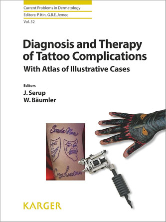 Diagnosis and Therapy of Tattoo Complications: With Atlas of Illustrative Cases (Current Problems in Dermatology, Vol. 52) (PDF)