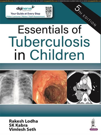 Essentials of Tuberculosis in Children 5th Edition (PDF)