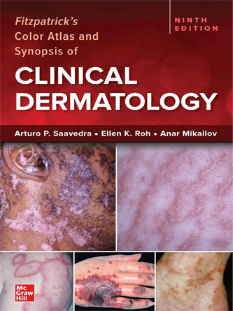 Fitzpatrick’s Color Atlas and Synopsis of Clinical Dermatology 9th Edition (PDF)