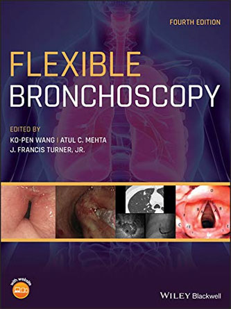 Flexible Bronchoscopy 4th Edition (PDF Publisher)