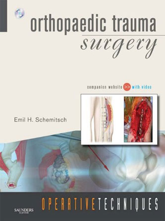 Operative Techniques : Orthopaedic Trauma Surgery (PDF)