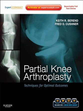 Partial Knee Arthroplasty: Techniques for Optimal Outcomes (PDF)