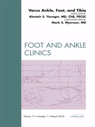 Varus Foot, Ankle and Tibia, An Issue of Foot and Ankle Clinics (PDF Publisher)