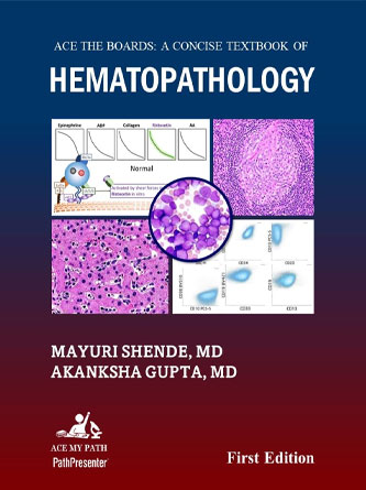 Ace The Boards: A Concise Textbook of Hematopathology (PDF)