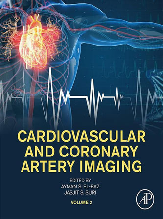 Cardiovascular and Coronary Artery Imaging: Volume 2 (Original PDF)