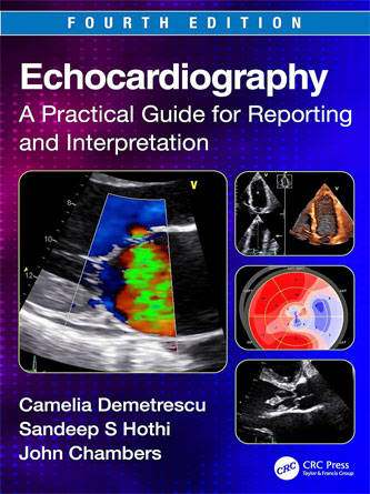 Echocardiography: A Practical Guide for Reporting and Interpretation, 4th Edition (PDF)