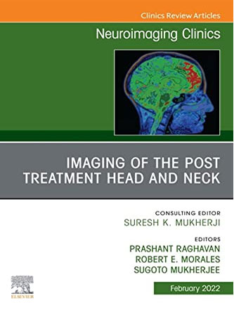 Imaging of the Post Treatment Head and Neck, An Issue of Neuroimaging Clinics of North America, E-Book (Clinics Collections) (PDF)