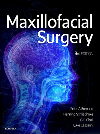 Maxillofacial Surgery: 2-Volume Set, 3rd Edition (PDF)