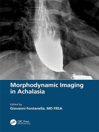 Morphodynamic Imaging in Achalasia (Original PDF)