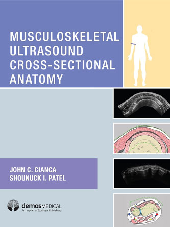 Musculoskeletal Ultrasound Cross-Sectional Anatomy (PDF)