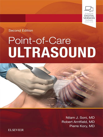 Point of Care Ultrasound, 2nd Edition (PDF)