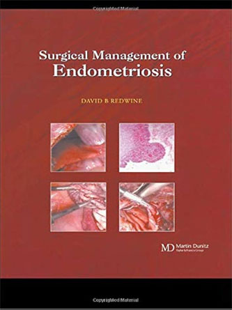 Surgical Management of Endometriosis (PDF)