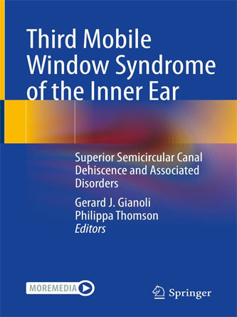 Third Mobile Window Syndrome of the Inner Ear: Superior Semicircular Canal Dehiscence and Associated Disorders (PDF)