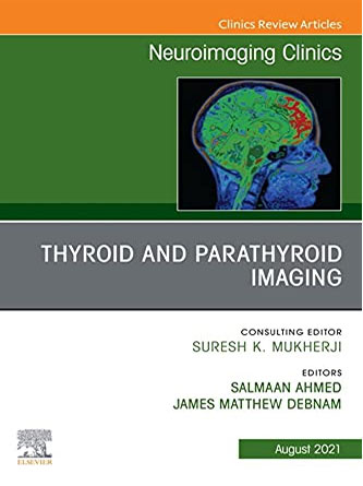 Thyroid and Parathyroid Imaging, An Issue of Neuroimaging Clinics of North America (The Clinics: Radiology, Volume 31-3) (PDF)