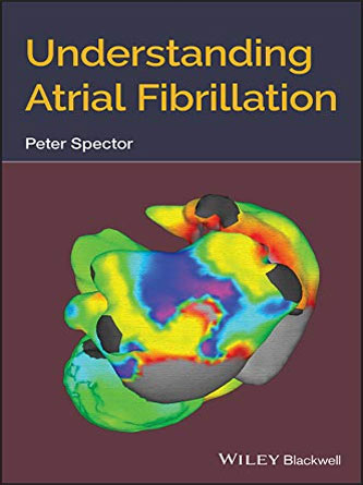 Understanding Atrial Fibrillation (Original PDF)