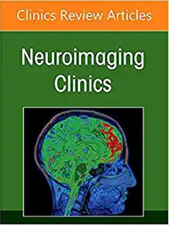 Neuroimaging Anatomy, Part 1: Brain and Skull, An Issue of Neuroimaging Clinics of North America (Volume 32-3) (The Clinics: Internal Medicine, Volume 32-3) (PDF)