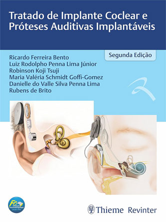 Tratado de Implante Coclear e Próteses Auditivas Implantáveis, 2nd Edition (EPUB)