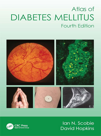 Atlas of Diabetes Mellitus 4th Edition (Original PDF)