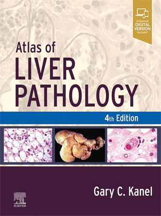 Atlas of Liver Pathology 4th Edition (Original PDF)