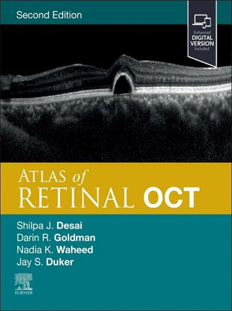 Atlas of Retinal OCT: Optical Coherence Tomography 2nd Edition (PDF)