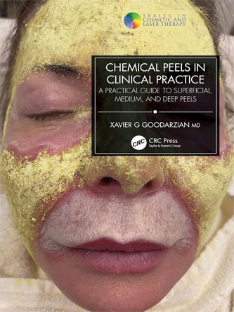 Chemical Peels in Clinical Practice: A Practical Guide to Superficial, Medium, and Deep Peels (Original PDF)