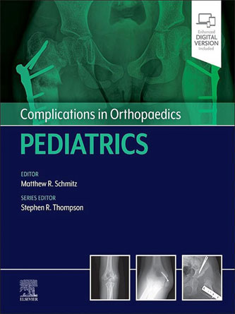 Complications in Orthopaedics: Pediatrics (PDF)